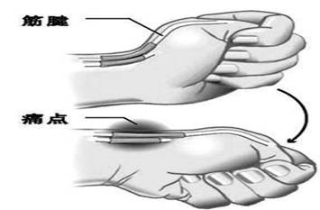 u=2371513695,3889576954&fm=173&app=25&f=JPEG